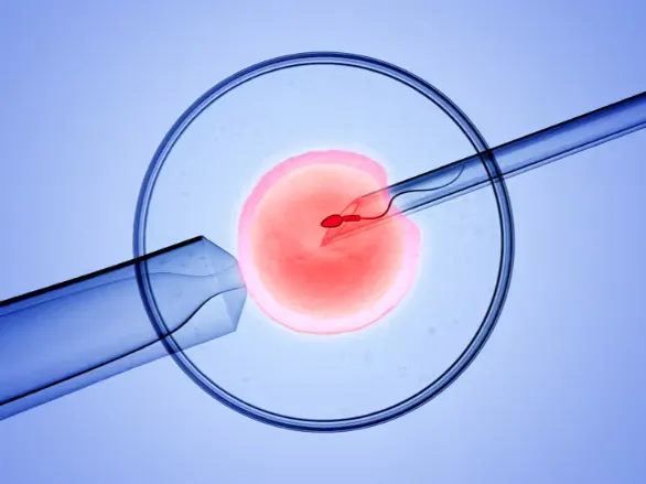 why choose ivf in albania